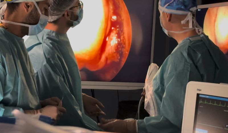 Intervento per meningocele in endoscopia